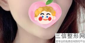 北京兔唇修复比较有权威医院，全国兔唇修复哪家医院良好