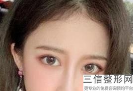 北京修复眼角厉害的医生，广州比较有名眼部修复医生