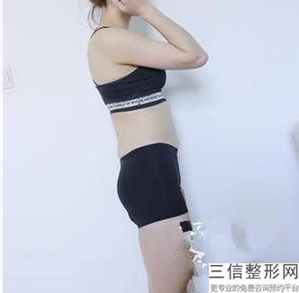 北京英煌隆胸怎么样，北京英煌北京英煌丰胸是真的
