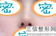 北京做完膨体隆鼻，北京膨体隆鼻前后效果