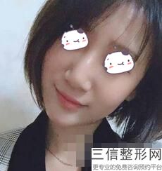 鼻基底填充手术是怎么做的，鼻基底填充术后