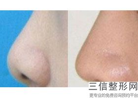 鼻修复良好的医院，全国鼻修复良好的医生