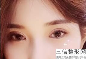 不开刀去眼袋哪家医院好点，开刀去眼袋哪个医院好