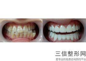 沧州莱恩口腔怎么样，沧州莱恩口腔医院怎么样