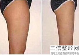 常熟丰胸哪家好，常熟时代整形美容医院怎么样