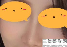 常熟隆鼻医院哪家好，常熟隆鼻医院哪家好点