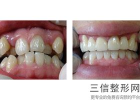 常州湖塘哪个看牙好，常州哪里牙科既好又实惠