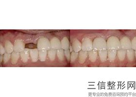 常州钟楼区好的牙科医院有哪些呢，常州钟楼区好的牙科医院有哪些医院