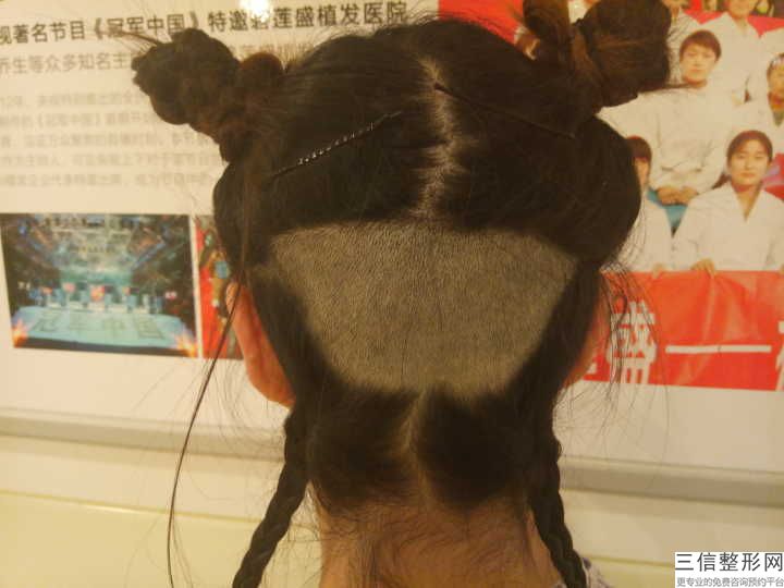 成都恒美植发地址,成都恒美植发医院简介