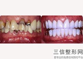 成都极光牙科医院怎么样，成都极光牙科电话
