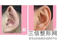成都米兰柏羽整形医院怎么样，成都耳朵整形哪个医院良好的医院