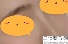 成都米兰柏羽做鼻子良好的医生是哪个，米兰柏羽隆鼻哪个医生良好