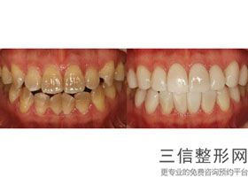 成都唐牙科价格，成都唐牙科金沙店