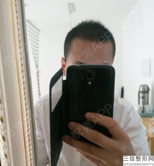 成都正规植发机构排名上有8家,比较好的是哪家,成都正规植发机构排名上有8家,比较好的是哪个