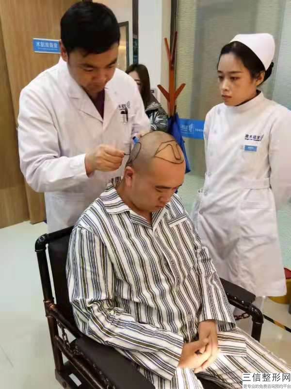 成都正规植发医院排行，成都植发医院哪家医技术好