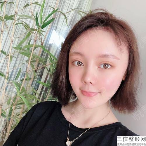 赤峰植发医院有哪些,呼和浩特植发医院排名