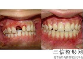 徐州24小时口腔医院有哪些地方，徐州市口腔医院是24小时的吗