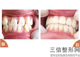许昌市植得口腔医院，许昌植得口腔医院价目表较新