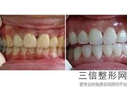 延安哪个牙科比较好，延安哪个医院看牙好点