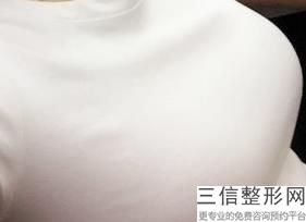 盐城隆胸医院排名榜前十名，盐城隆胸医院排名榜前十