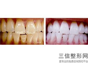 阳江牙科医院哪家好，阳江市哪里看牙好