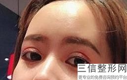 宜昌看眼睛的医院哪家好,眼科医院宜昌