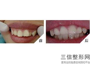 宜兴整牙哪家医院好一点,宜兴整牙哪家医院好点