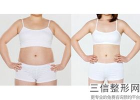银川抽脂丰胸手术医院哪家良好，银川抽脂隆胸价格