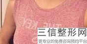 银川抽脂隆胸价格，银川华美整容价格