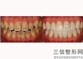 银川诺贝尔口腔价目表,银川市诺贝尔口腔医院