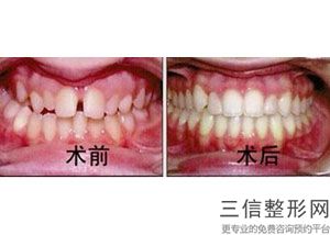 银川诺贝尔牙科医院怎么样，宁夏银川诺贝尔口腔门诊部怎么样