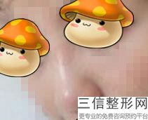 雕线隆鼻价格多少(新怎样化妆可以让鼻梁看起来高一些)