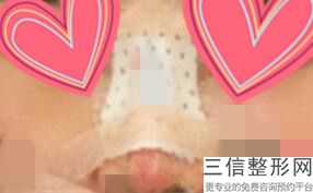 多少钱自体隆鼻(新上海自体隆鼻多少钱感情这个问题很复杂)