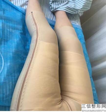 朵朵隆胸手术(新姐妹团朵朵丰胸 谁用过效果怎么样)
