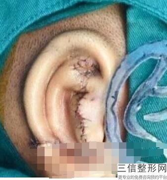 耳朵软可以做耳软骨隆鼻吗(新半大狗狗耳朵突然向后卷是什么原因)