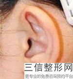 耳软骨隆鼻的价格表(新汪垟做个耳软骨隆鼻大概多少钱)