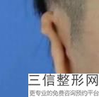 耳软骨隆鼻的吸收率(新花王水漆涂墙几年后会变黄色吗)