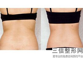 丰丽果丰胸效果好么(新d女郎丰胸产品有人用过吗)