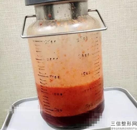 丰胸对身体有害处吗(新6s棉花胸有什么危害)