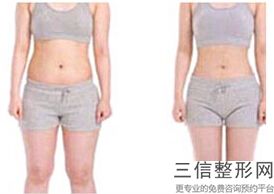 丰胸对身体有什么(新喝丰胸产品对身体有害吗)