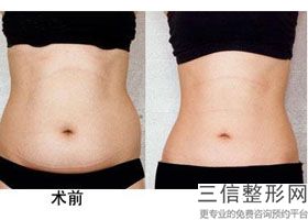 丰胸好办法丰胸(新怎么样丰胸效果更好)