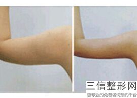 丰胸好用么(新丰韵丰胸霜真的可以丰胸吗)