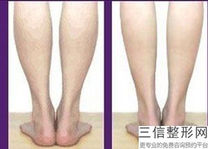 丰胸后可以抽烟吗(新丰胸达人小云老师是真的吗)