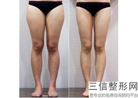 丰胸隆胸多少费用(新正规的丰胸产品在哪里能买到)