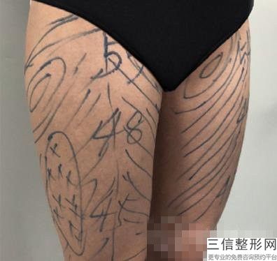 丰胸哪比较好(新什么丰胸产品效果好)