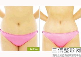 丰胸哪家专业(新请问谁知道：天美乳腺专科医院技术好不好大家可以说一下吗)