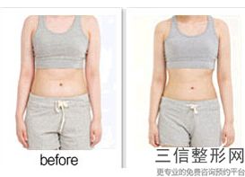 丰胸哪里安全(新我家狗下崽后有个乳头不出奶乳房)