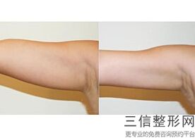 丰胸哪里的好(新喝九育丰润膏是真的可以丰胸吗_紫一商城)
