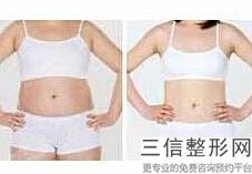 丰胸 效果 好(新用什么方法才会真正达到丰胸效果)