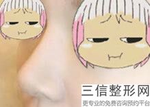 鼻综合需要多少钱(鼻综合一般价格多少钱)